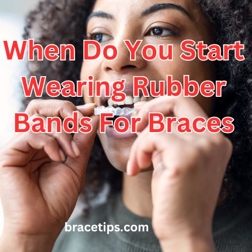 When Do You Start Wearing Rubber Bands For Braces