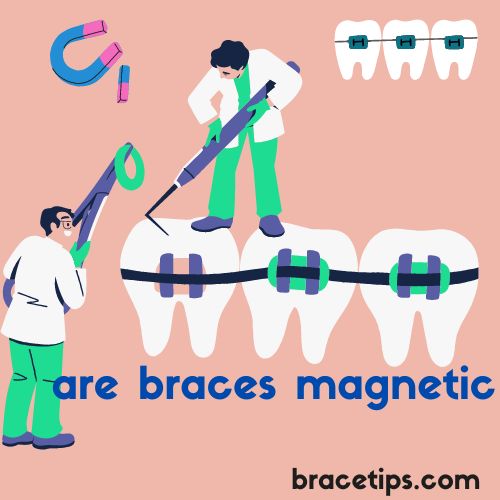 Are Braces Magnetic