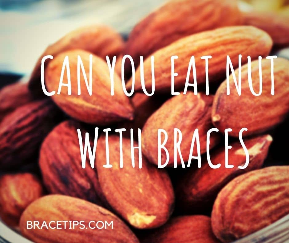 Can You Eat Nuts With Braces