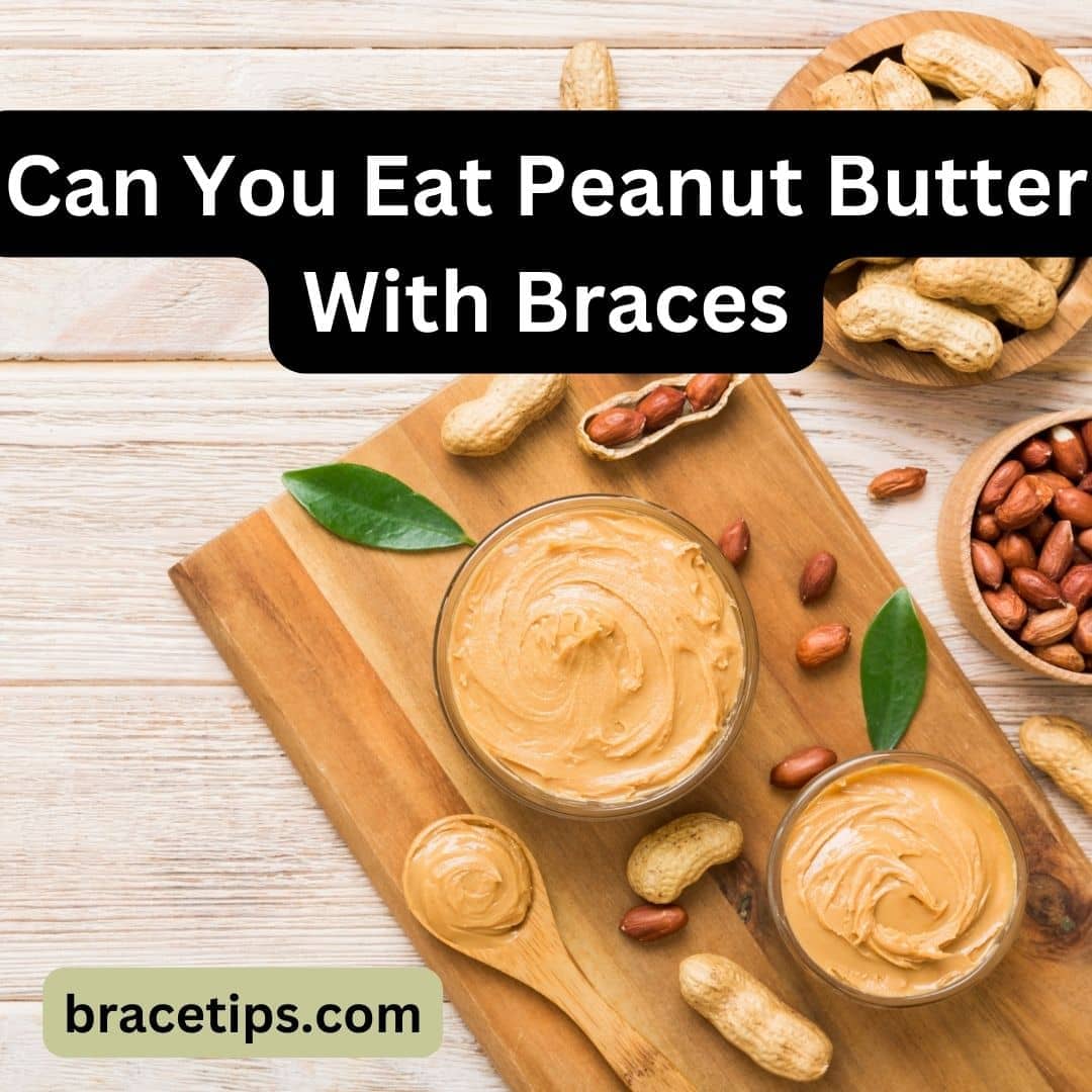 Can You Eat Peanut Butter With Braces