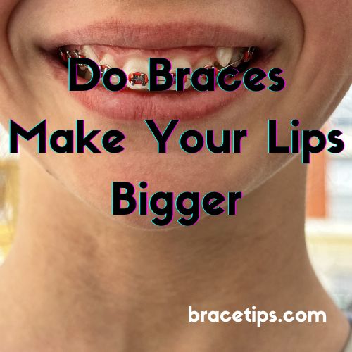 Do Braces Make Your Lips Bigger