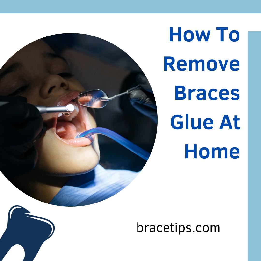 How To Remove Braces Glue At Home