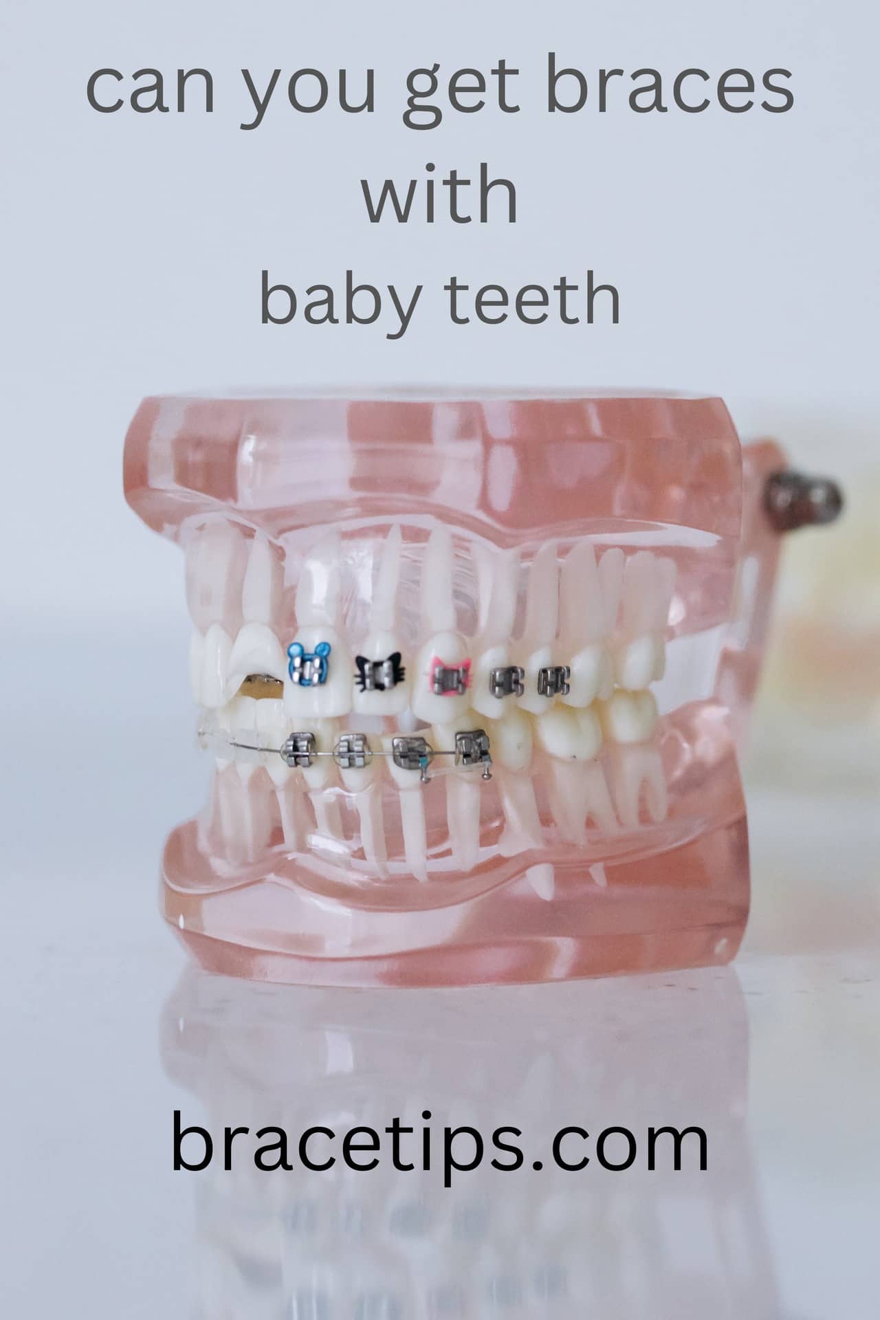 Can You Get Braces With Baby Teeth