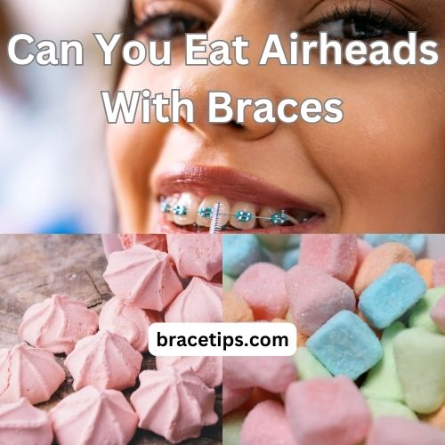 Can You Eat Airheads With Braces