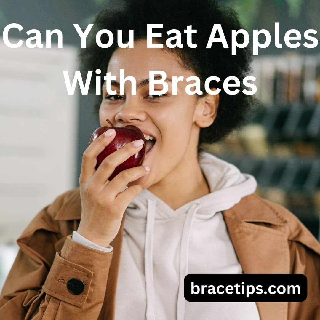 Can You Eat Apples With Braces