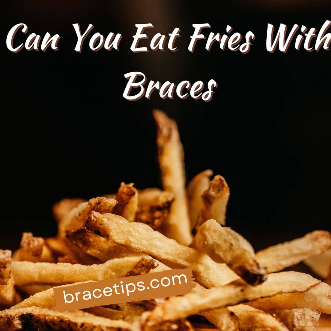 Can You Eat Fries With Braces