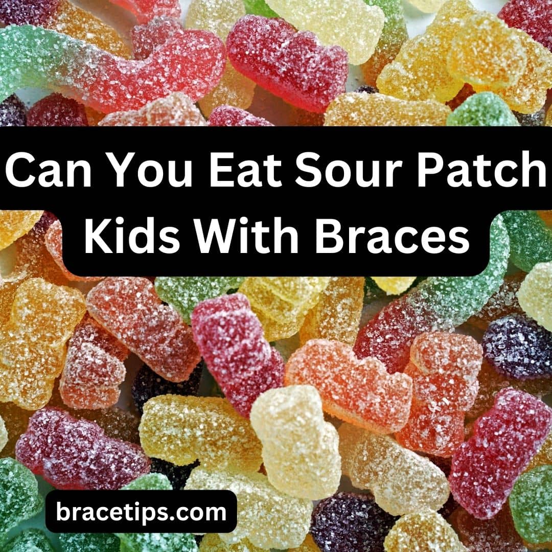 Can You Eat Sour Patch Kids With Braces