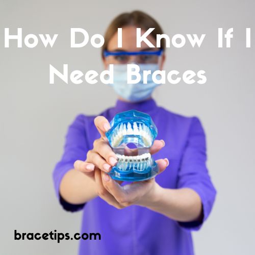 How Do I Know If I Need Braces