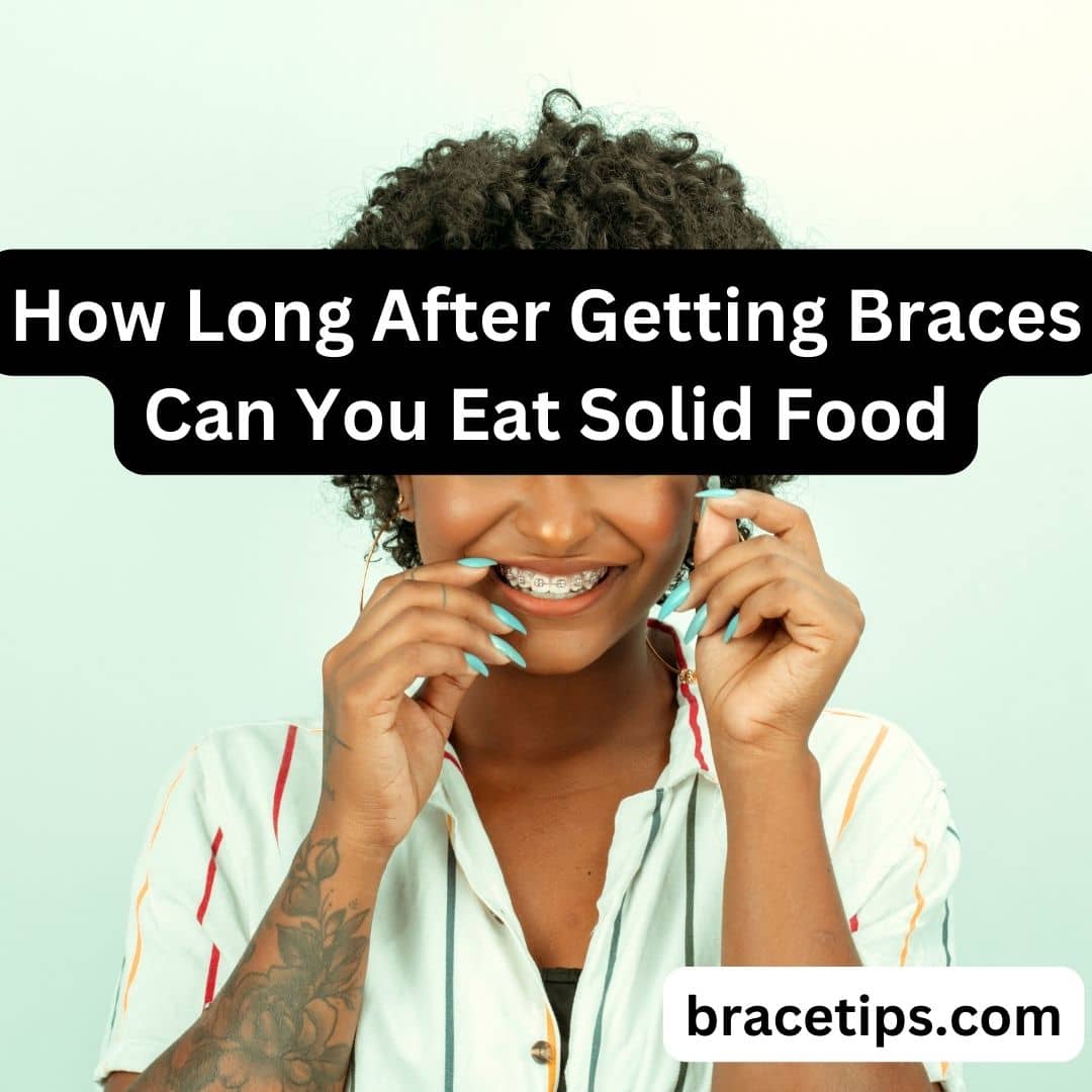 How Long After Getting Braces Can You Eat Solid Food