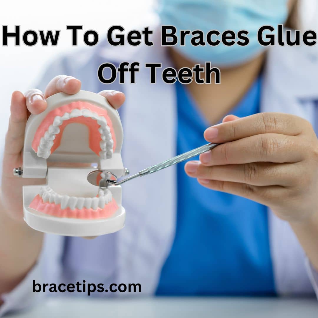 How To Get Braces Glue Off Teeth