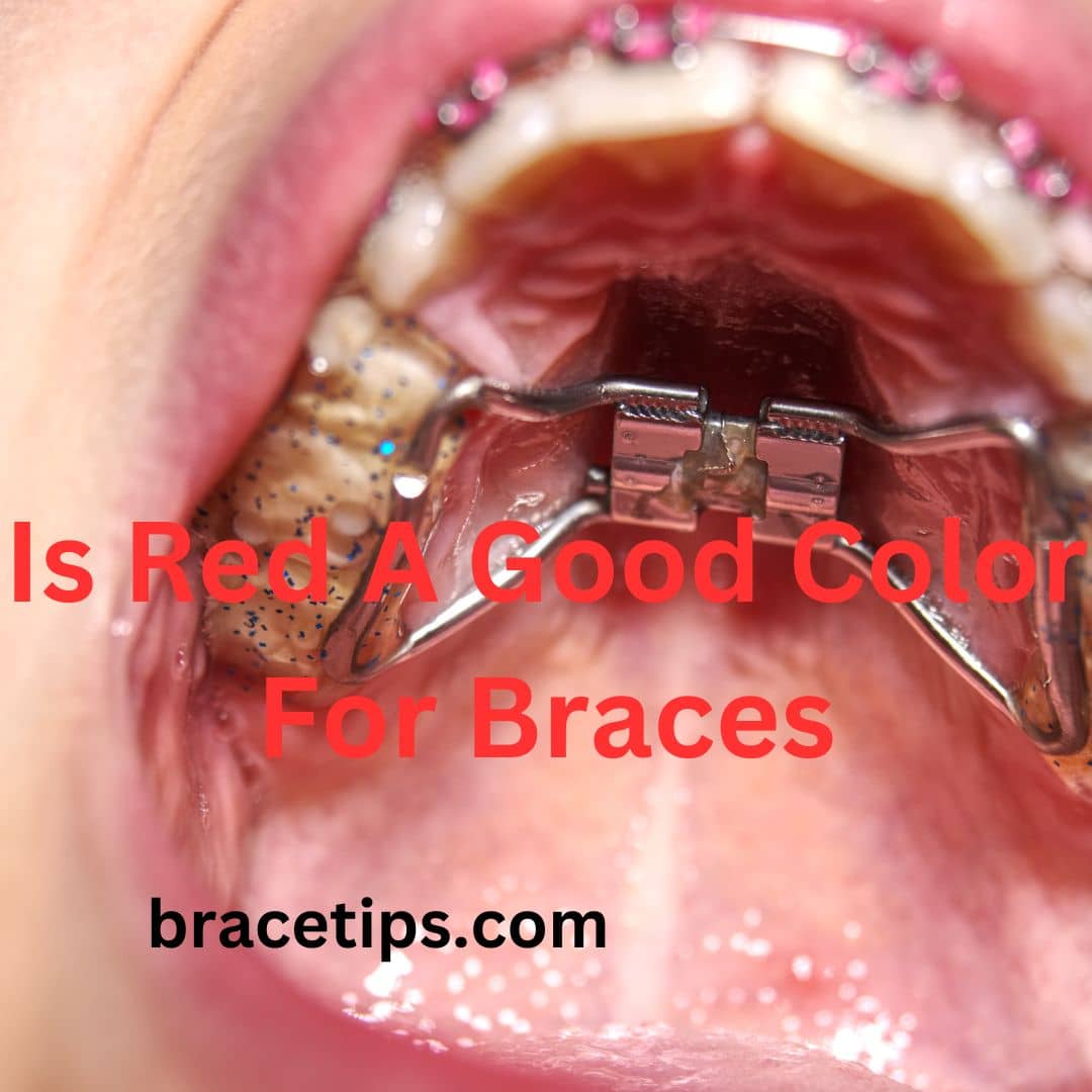 Is Red A Good Color For Braces