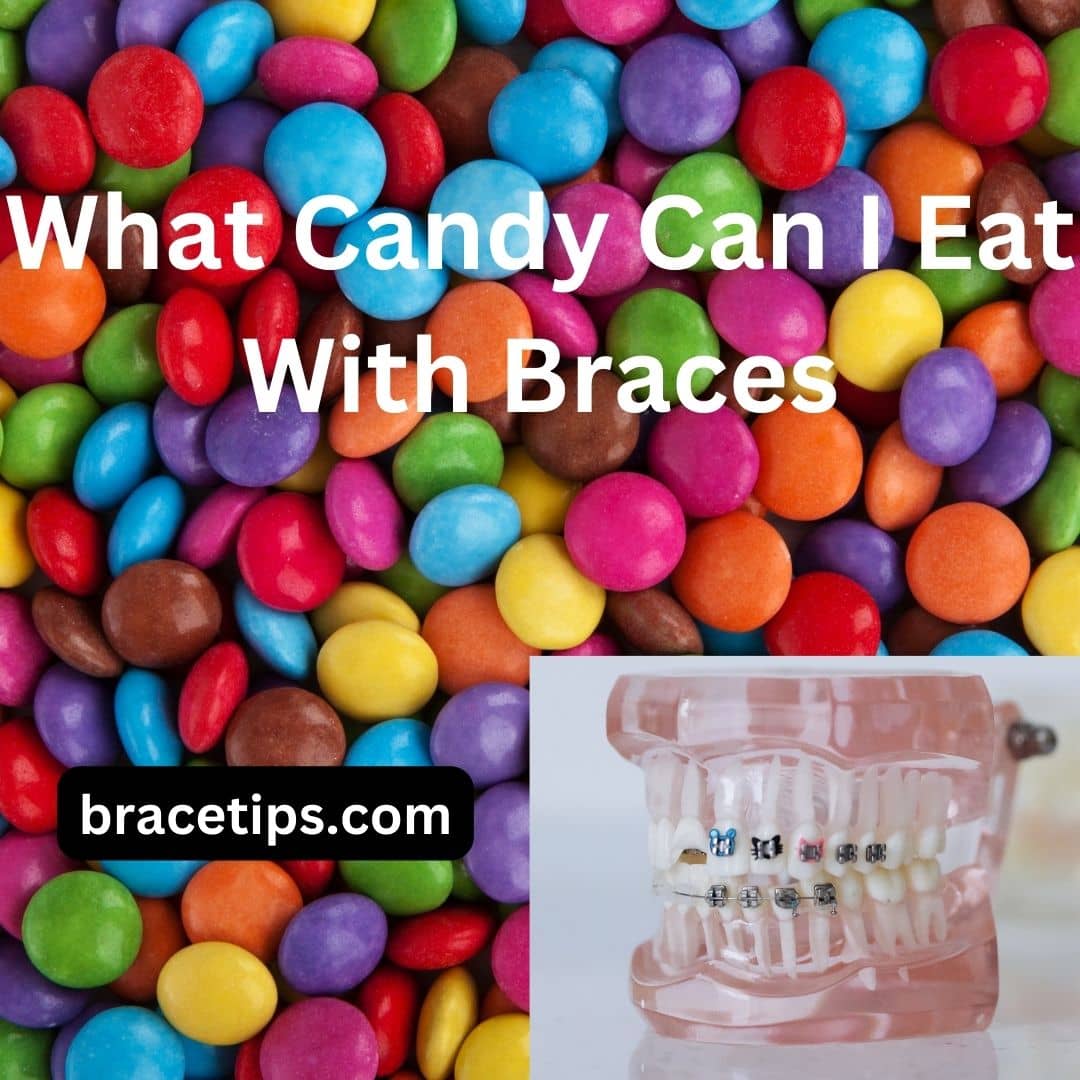 What Candy Can I Eat With Braces