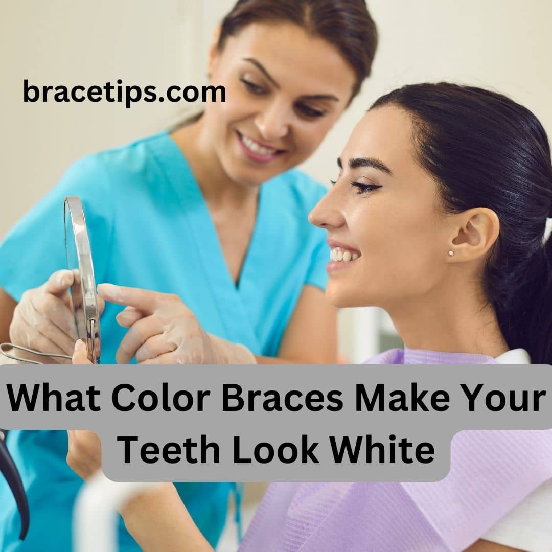 What Color Braces Make Your Teeth Look White