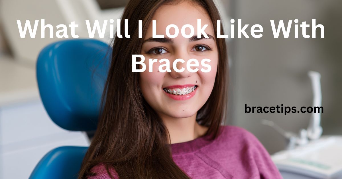 What Will I Look Like With Braces