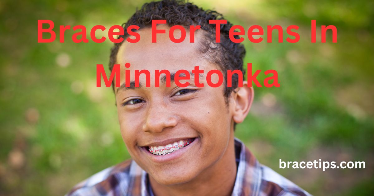 Braces For Teens In Minnetonka
