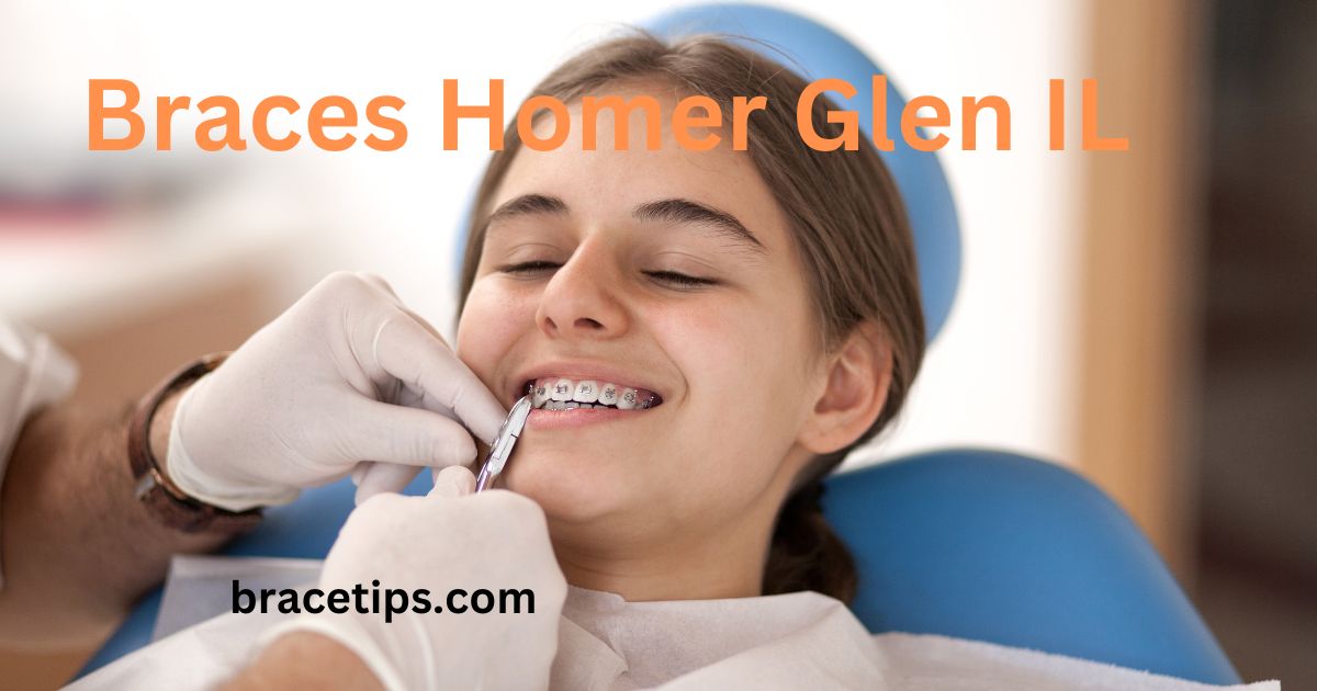 Braces Homer Glen IL