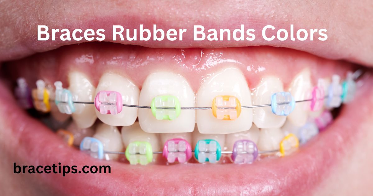 Braces Rubber Bands Colors