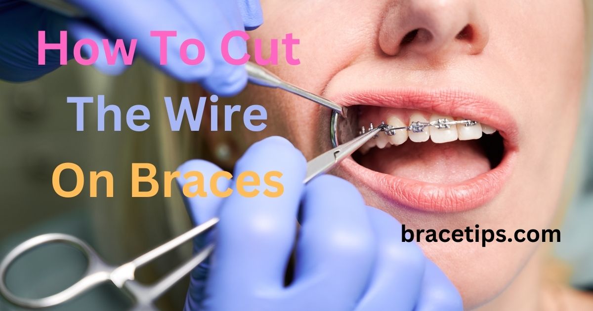 How To Cut The Wire On Braces