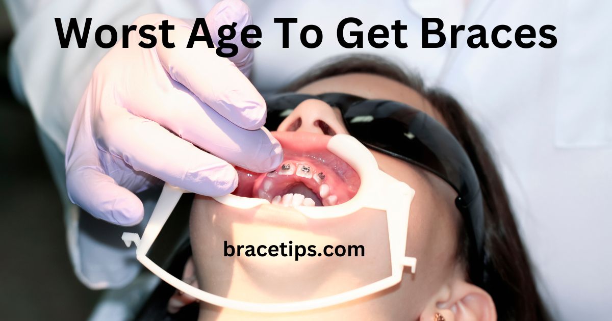 Worst Age To Get Braces